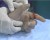 علائم و درمان پارگی تاندون دست