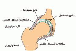 کلیات آناتومی مفصل ران در ناحیه لگن