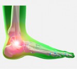 عوامل ایجاد درد ساق پا