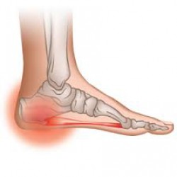 روش هایی برای درمان و کاهش درد پاشنه پا