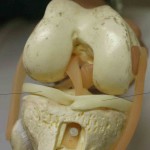 knee_meniscus_model-150x150